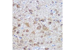 Immunohistochemistry of paraffin-embedded rat brain using EL Rabbit pAb (ABIN7266914) at dilution of 100 (40x lens).