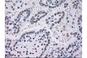 Image no. 1 for anti-Polo-Like Kinase 1 (PLK1) antibody (ABIN1500281)