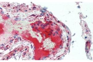 Detection of C5a in Human Small Intestine Tissue using Polyclonal Antibody to Complement Component 5a (C5a)
