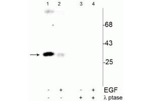 Western blot of human T47D cells showing specific immunolabeling of the ~34 kDa cdc2 phosphorylated at Tyr15 (Control, Lane 1). (CDK1 anticorps  (pTyr15))