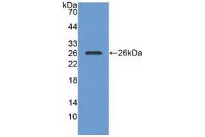 Figure. (RASA1 anticorps  (AA 403-596))