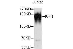 Western blot analysis of extracts of Jurkat cells, using KRI1 antibody (ABIN6294054) at 1:3000 dilution.