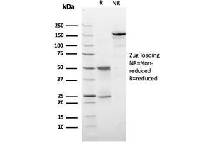 SDS-PAGE Analysis Purified HER-2 Monospecific Mouse Monoclonal Antibody (ERBB2/3257). (ErbB2/Her2 anticorps  (AA 311-462))