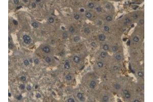 Detection of Hpt in Human Liver Tissue using Monoclonal Antibody to Haptoglobin (Hpt)