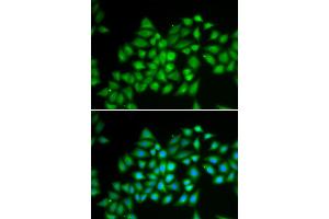 Immunofluorescence analysis of HeLa cells using ATP2A2 antibody. (ATP2A2 anticorps)