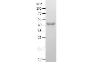 Western Blotting (WB) image for Meis Homeobox 3 (MEIS3) (AA 1-358) protein (His tag) (ABIN7123878)