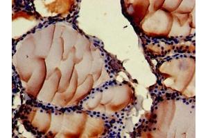 Immunohistochemistry of paraffin-embedded human thyroid tissue using ABIN7144771 at dilution of 1:100