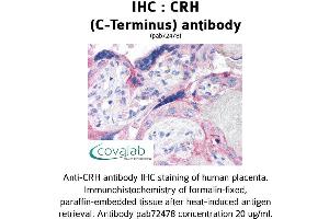 Image no. 1 for anti-Corticotropin Releasing Hormone (CRH) (C-Term) antibody (ABIN1733308) (CRH anticorps  (C-Term))
