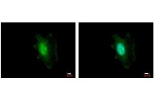 ICC/IF Image DDB1 antibody [C3], C-term detects DDB1 protein at cytoplasm and nucleus by immunofluorescent analysis.
