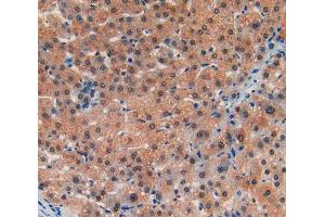 IHC-P analysis of liver tissue, with DAB staining. (LIFR anticorps  (AA 45-184))
