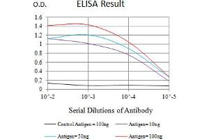 Black line: Control Antigen (100 ng),Purple line: Antigen (10 ng), Blue line: Antigen (50 ng), Red line:Antigen (100 ng)