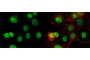 ICC/IF Image O-GlcNAc transferase antibody detects O-GlcNAc transferase protein at cytoplasm and nucleus by immunofluorescent analysis.