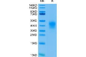 Human CD79B on Tris-Bis PAGE under reduced condition. (CD79b Protein (AA 29-159) (His-Avi Tag))