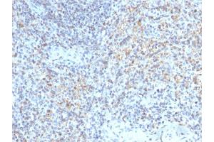 Formalin-fixed, paraffin-embedded human Spleen stained with CD40 Ligand Mouse Monoclonal Antibody (CD40LG/2763). (CD40 Ligand anticorps  (AA 108-261))