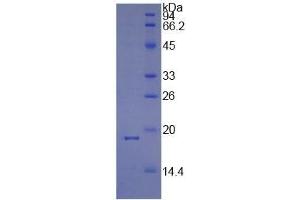 SDS-PAGE of Protein Standard from the Kit (Highly purified E. (PPIA Kit ELISA)