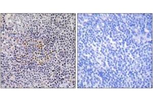 Immunohistochemistry (IHC) image for anti-X-Ray Repair Complementing Defective Repair in Chinese Hamster Cells 3 (XRCC3) (AA 41-90) antibody (ABIN2890031) (XRCC3 anticorps  (AA 41-90))