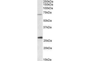 Western Blotting (WB) image for anti-Carnitine Palmitoyltransferase 2 (CPT2) (AA 141-154) antibody (ABIN490676) (CPT2 anticorps  (AA 141-154))