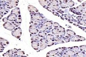 Immunohistochemistry analysis of paraffin-embedded rat pancreas using,NUDT22 (ABIN7074928) at dilution of 1: 7200 (NUDT22 anticorps)