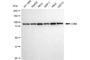 Western blotting analysis using CHM antibody (ABIN7798057).