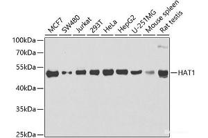 Western blot analysis of extracts of various cell lines using HAT1 Polyclonal Antibody at dilution of 1:1000. (HAT1 anticorps)