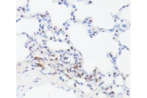 Immunohistochemistry of paraffin-embedded Rat lung using Phospho-MYC(S62) Polyclonal Antibody at dilution of 1:100 (40x lens).