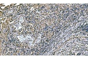 IHC analysis of NEDD4 using anti-NEDD4 antibody (ABIN7599536).