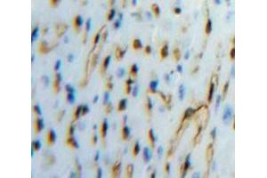 Used in DAB staining on fromalin fixed paraffin-embedded Heart tissue