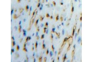 Used in DAB staining on fromalin fixed paraffin-embedded Heart tissue (TFPI anticorps  (AA 29-306))