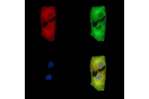 ABIN7095632 and ABIN7099694 staining  cells by IF/ICC.