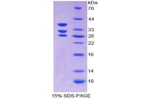 SDS-PAGE analysis of Mouse ICA1 Protein. (ICA1 Protéine)