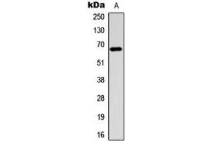 Western blot analysis of Estrogen Receptor alpha (pS106) expression in MCF7 EGF-treated (A) whole cell lysates. (Estrogen Receptor alpha anticorps  (pSer106))