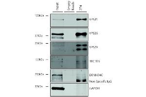 Immunoprecipitation analysis using Mouse Anti-VPS35 Monoclonal Antibody, Clone 7E4 (ABIN6932926). (VPS35 anticorps  (FITC))