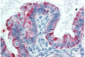 Human Uterus: Formalin-Fixed, Paraffin-Embedded (FFPE)