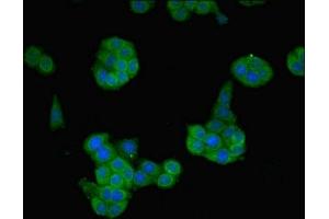Immunofluorescent analysis of PC-3 cells using ABIN7161468 at dilution of 1:100 and Alexa Fluor 488-congugated AffiniPure Goat Anti-Rabbit IgG(H+L)