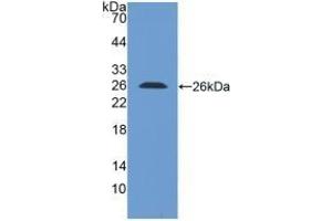Detection of Recombinant LILRB1, Human using Polyclonal Antibody to Leukocyte Immunoglobulin Like Receptor Subfamily B, Member 1 (LILRB1)