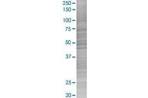 C18orf10 transfected lysate.