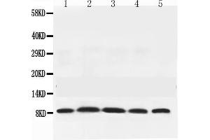Western blot analysis of NEDD8 expression in rat testis extract ( Lane 1), mouse thymus extract ( Lane 2), mouse brain extract ( Lane 3), HELA whole cell lysates ( Lane 4) and MCF-7 whole cell lysates ( Lane 5).