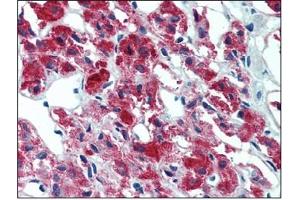 Immunohistochemistry (IHC) image for anti-Interleukin 23, alpha subunit p19 (IL23A) antibody (ABIN614363) (IL23A anticorps)