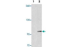 Western blot analysis of EPHA4 (arrow) using EPHA4 polyclonal antibody . (EPH Receptor A4 anticorps  (AA 40-70))