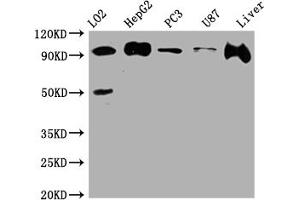 Western Blot Positive WB detected in: L02 whole cell lysate, HepG2 whole cell lysate, PC-3 whole cell lysate, U-87 whole cell lysate, Rat Liver whole cell lysate All lanes: ALIX antibody at 1:1000 Secondary Goat polyclonal to rabbit IgG at 1/50000 dilution Predicted band size: 97, 97, 31 kDa Observed band size: 97 kDa (Recombinant ALIX anticorps)