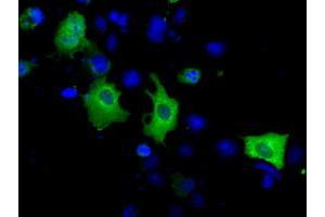 Image no. 7 for anti-Acetyl-CoA Acetyltransferase 2 (ACAT2) antibody (ABIN1496401) (ACAT2 anticorps)