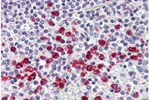 Human Spleen, Macrophages (formalin-fixed, paraffin-embedded) stained with MMP9 antibody ABIN337099 at 5 ug/ml followed by biotinylated anti-mouse IgG secondary antibody ABIN481714, alkaline phosphatase-streptavidin and chromogen. (MMP 9 anticorps)