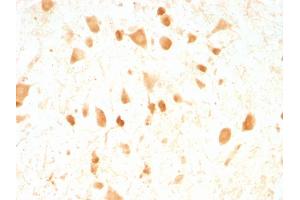 Formalin-fixed, paraffin-embedded Rat Cerebellum stained with Pgp9. (UCHL1 anticorps)