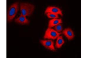 Immunofluorescent analysis of Tyrosine Hydroxylase staining in DLD cells. (Tyrosine Hydroxylase anticorps  (N-Term))