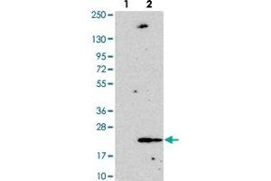 Western blot analysis of Lane 1: Negative control (vector only transfected HEK293T lysate). (ANAPC13 anticorps)