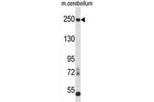 Western blot analysis in mouse cerebellum tissue lysates (35ug/lane) using CD171 / L1CAM Antibody . (L1CAM anticorps  (C-Term))