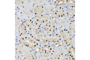 Immunohistochemistry of paraffin-embedded mouse kidney using RPS27A antibody (ABIN7270022) at dilution of 1:100 (40x lens).