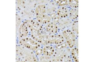 Immunohistochemistry of paraffin-embedded mouse kidney using RPS27A antibody (ABIN7270022) at dilution of 1:100 (40x lens). (RPS27A anticorps  (AA 1-156))