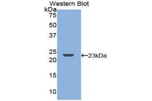 Western Blotting (WB) image for anti-Tumor Necrosis Factor Receptor Superfamily, Member 11a, NFKB Activator (TNFRSF11A) (AA 359-542) antibody (ABIN3205542) (TNFRSF11A anticorps  (AA 359-542))