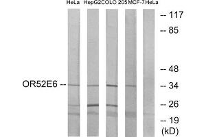 Western blot analysis of extracts from HeLa cells, HepG2 cells, COLO cells and MCF-7 cells, using OR52E6 antibody. (OR52E6 anticorps  (C-Term))